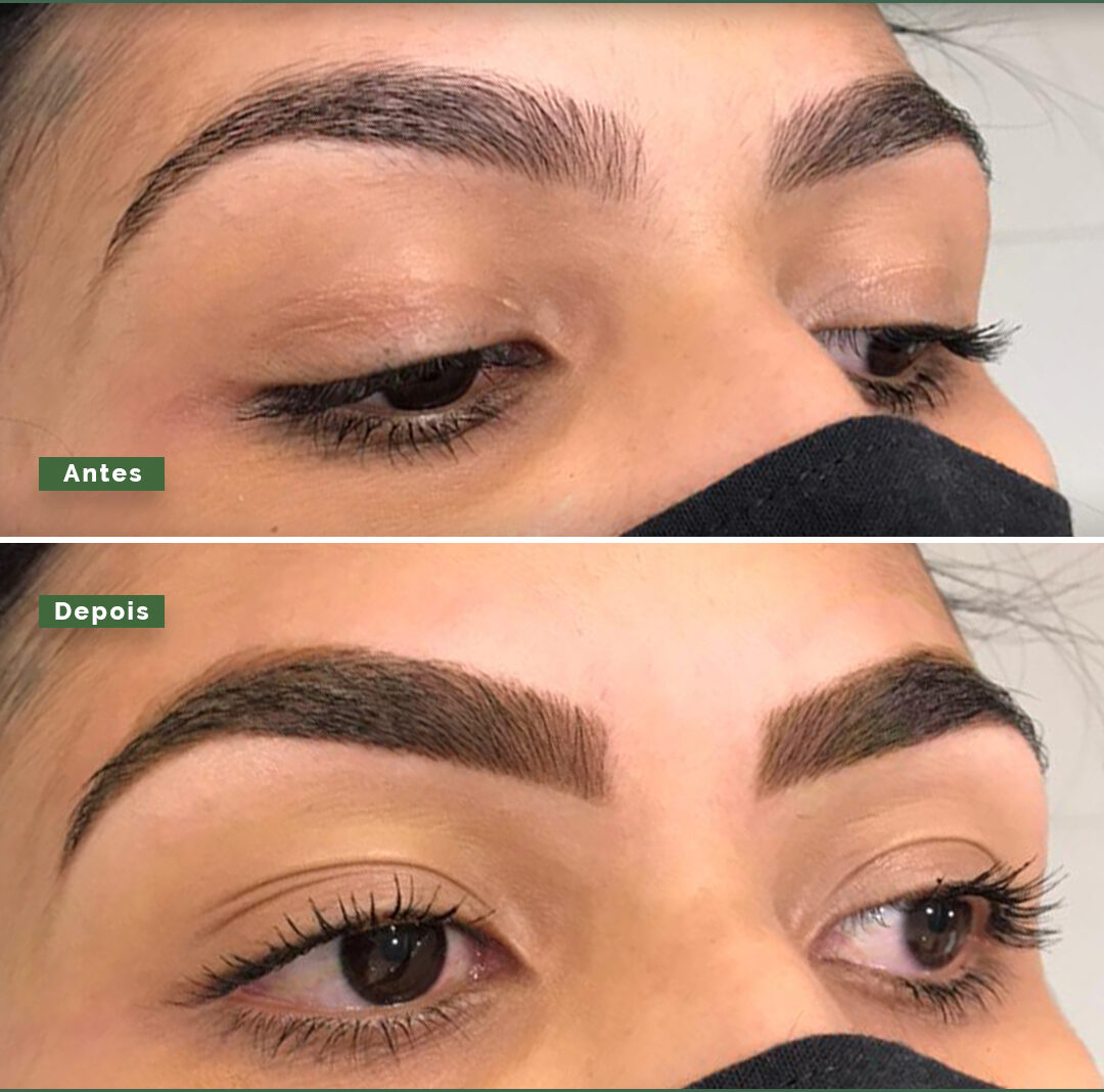 Story – Antes e depois – 1