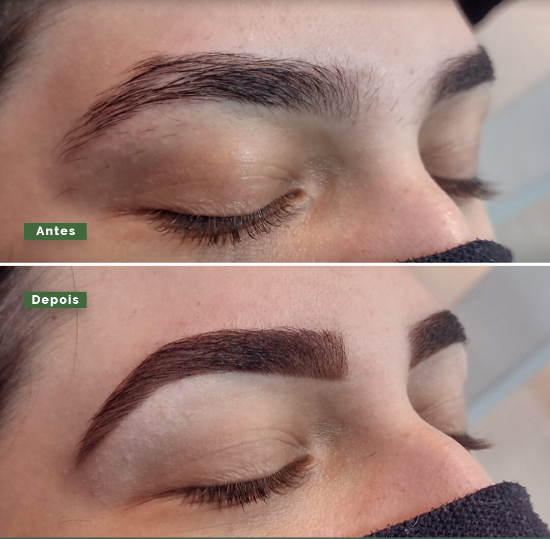 Story – Antes e depois – 2 (2)