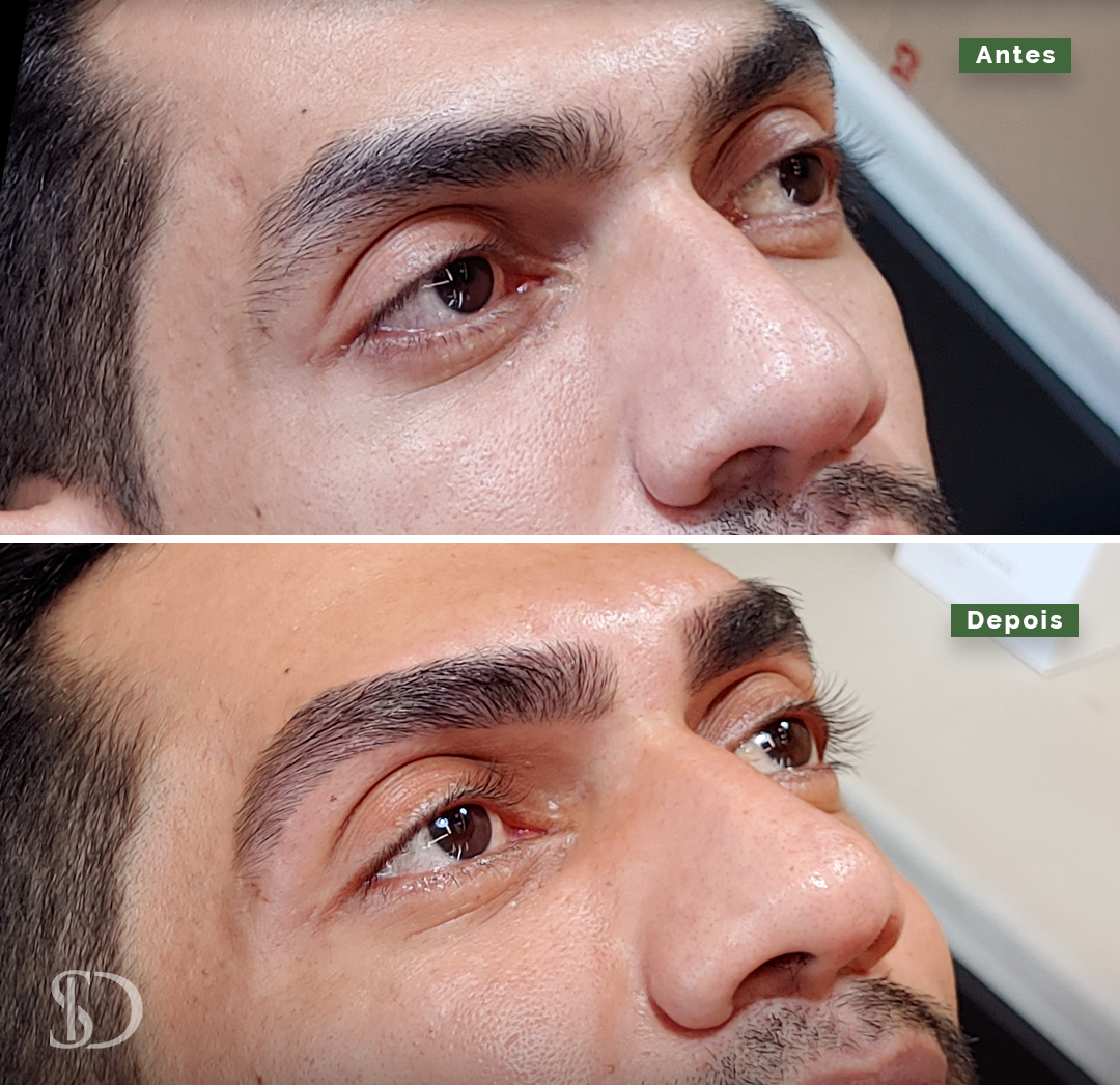 Story – Antes e depois – 2 copiar