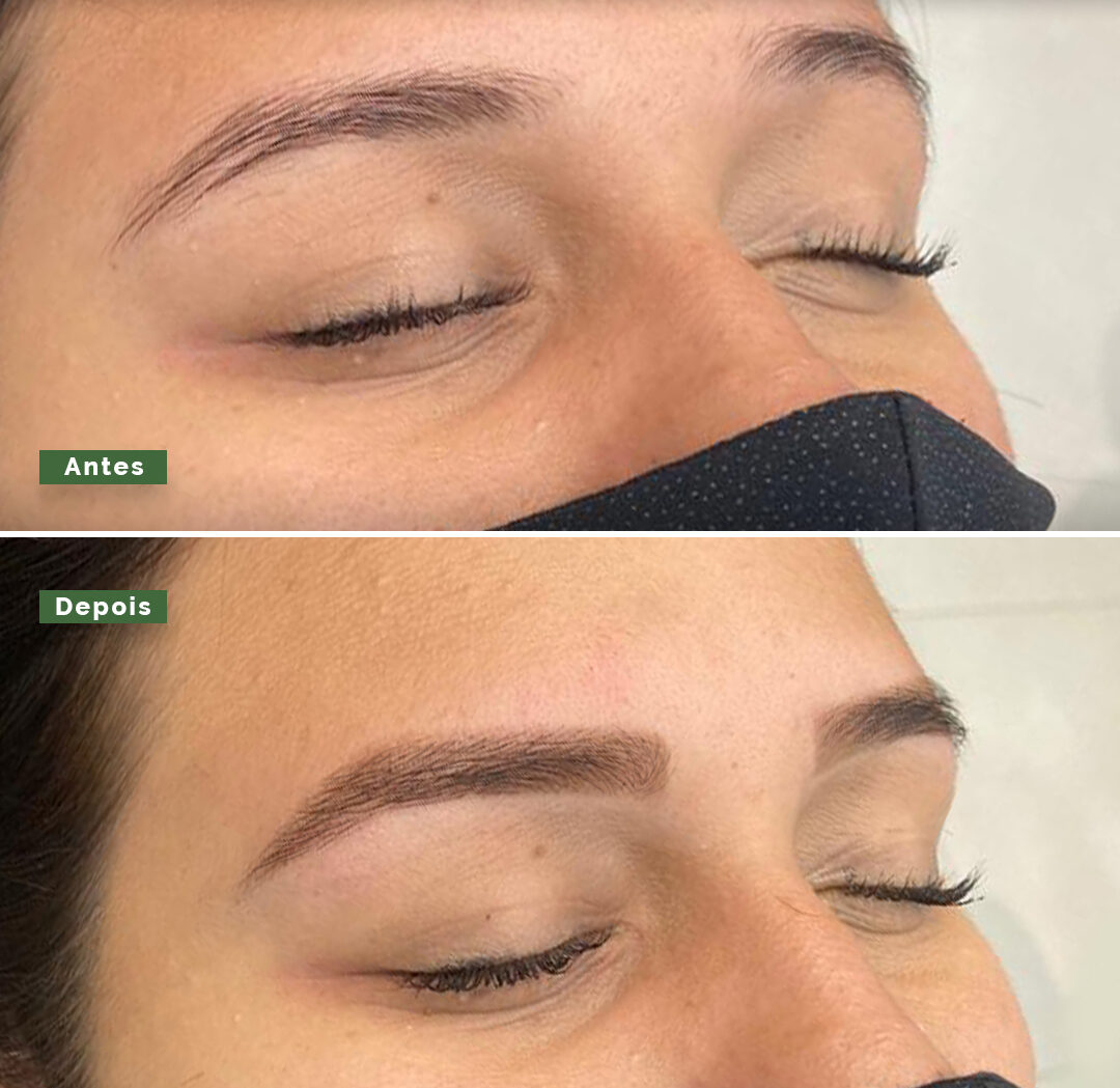 Story – Antes e depois – 2