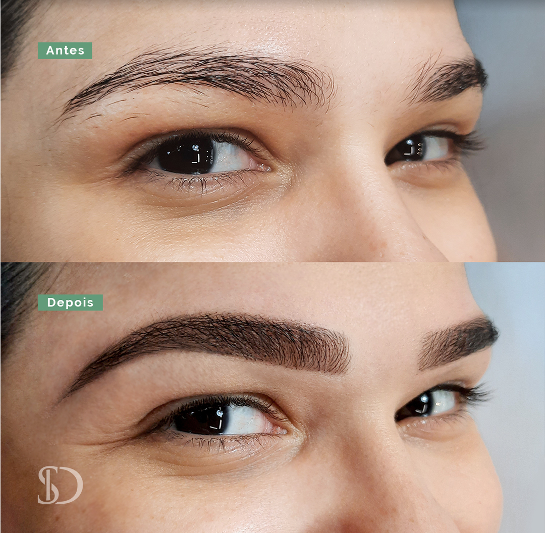 Story – Antes e depois – 2