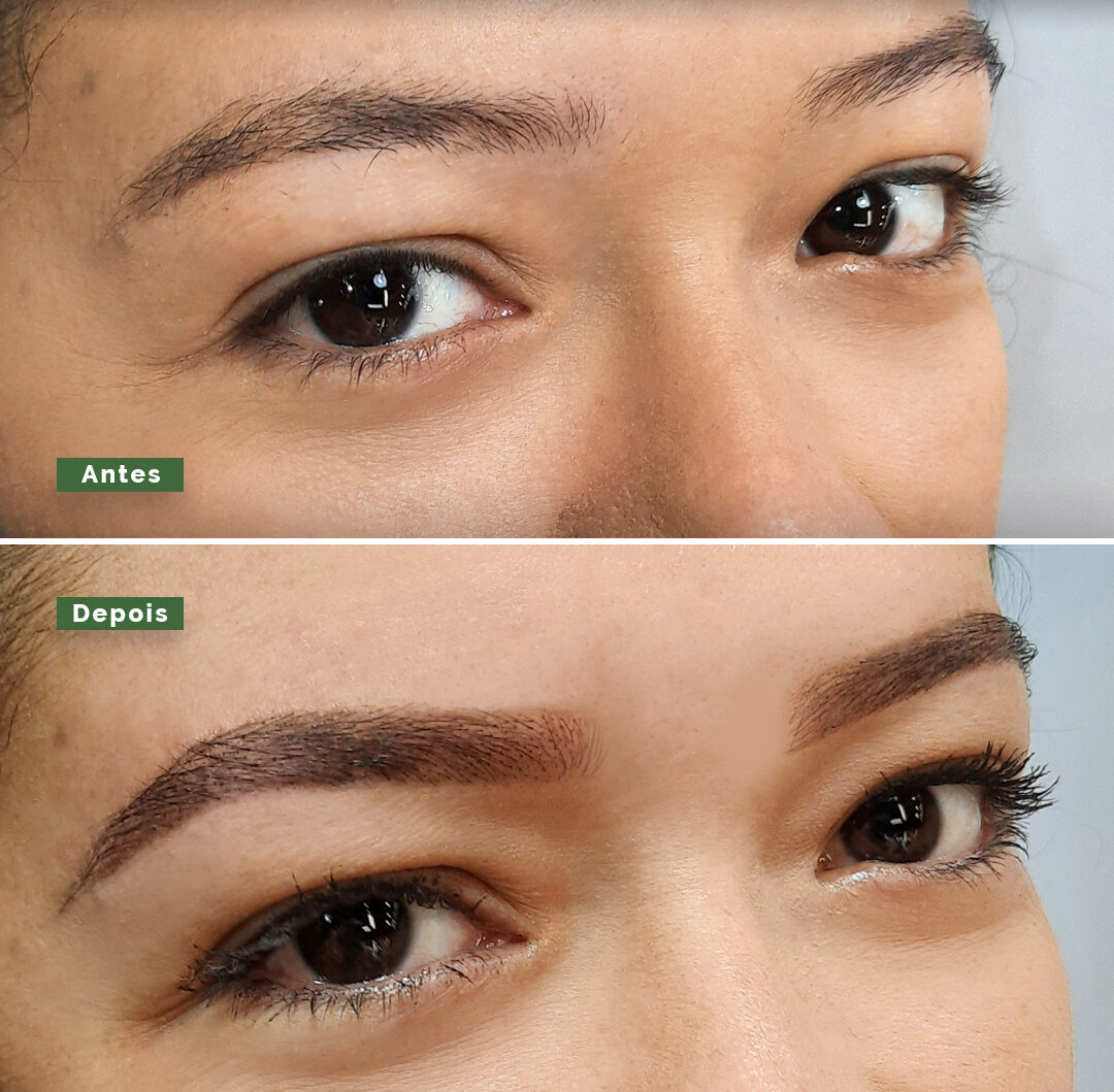 Story – Antes e depois – 3