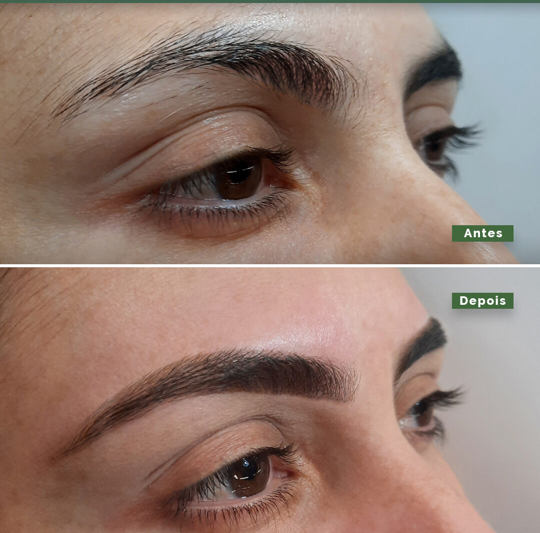 Story – Antes e depois – 4